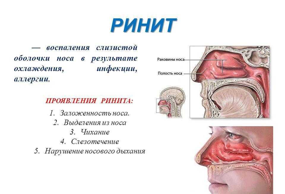 Что означает, если приснились сопли 👃 — топ-42 толкования по сонникам 📚: к чему снится мужчине или женщине сморкаться во сне и видеть у себя или ребенка насморк с кровью