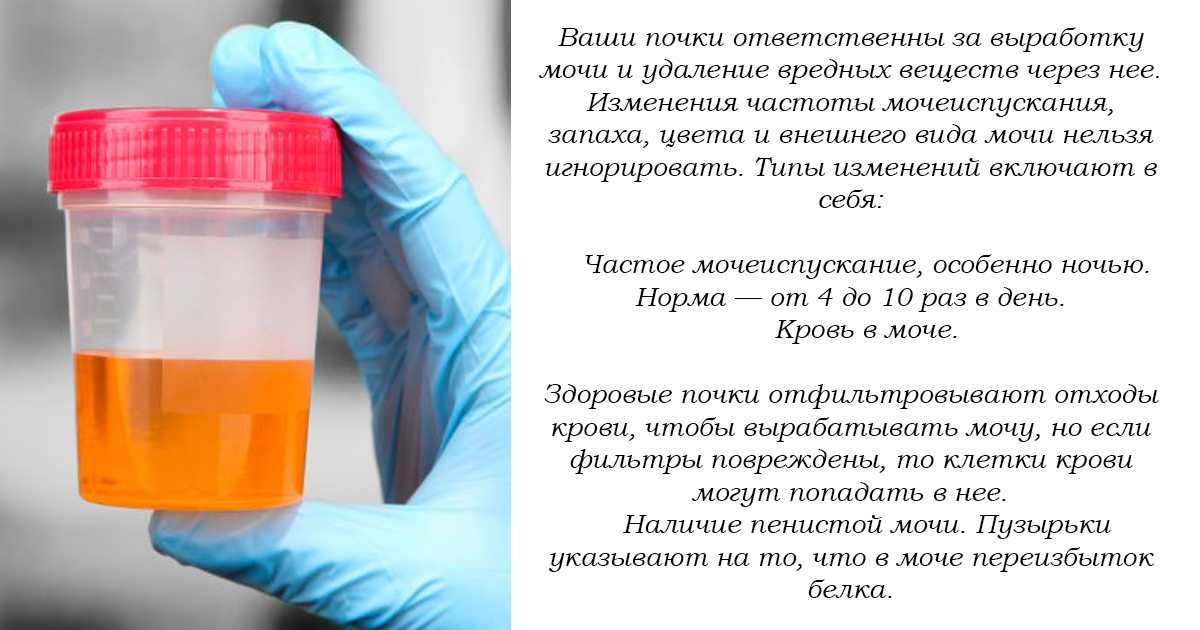 Сонник: снится моча чужого человека, мочеиспускание - к чему писать во сне?