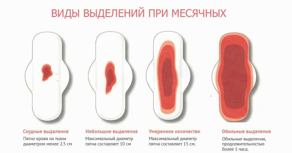 Если Вам снятся месячные, взаимоотношения с домочадцами могут наполниться трудностями и недопониманием Возможна беременность Вас окружают сплетни и