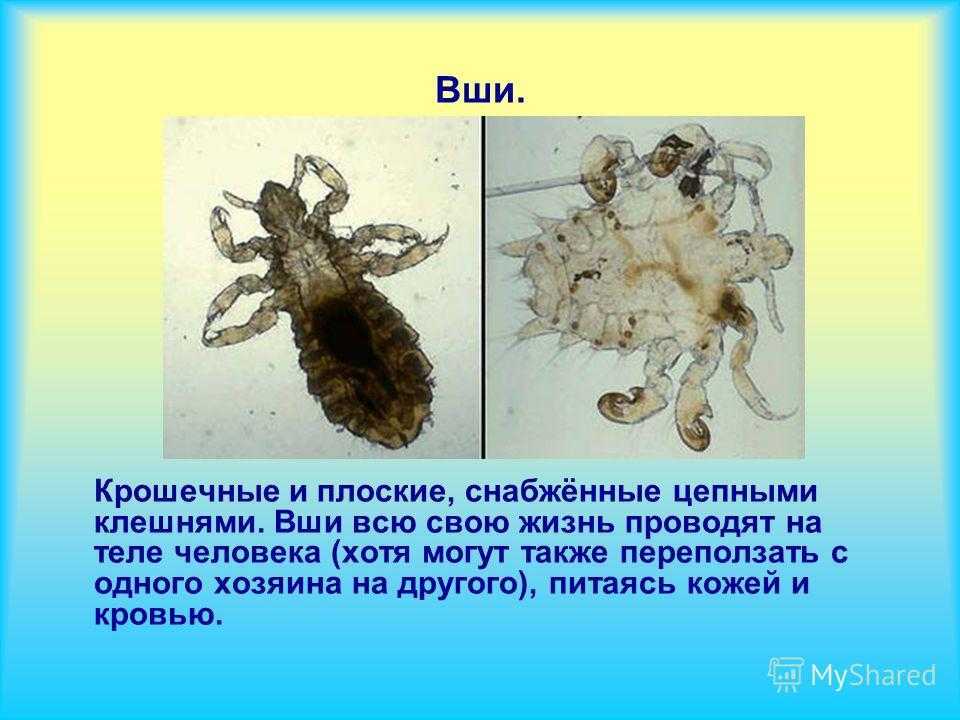 Гниды в волосах к чему снятся, толкование сна по различным сонникам