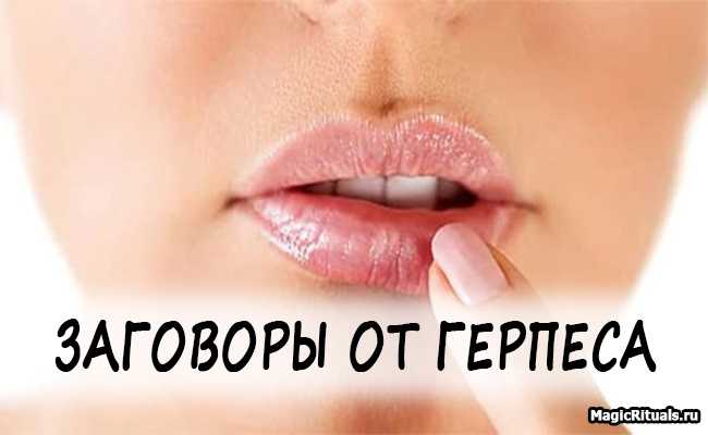 Подборка эффективных заговоров от герпеса на воду, свечи, огонь и зеркало В старину от герпеса избавлялись при помощи ритуала или молитвы Попробуйте один из вариантов на воду или отражение в зеркале