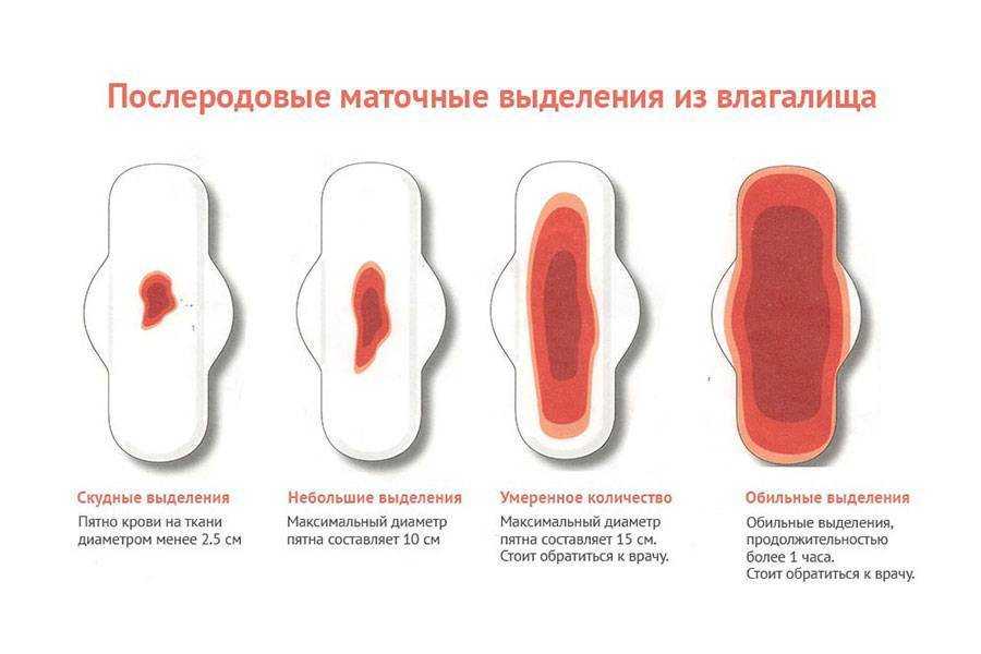 К чему снятся месячные - значение сна месячные по соннику