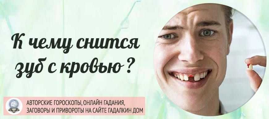 Приснилось выпадение зубов без крови, выпал один зуб, несколько или все, больной или здоровый зуб