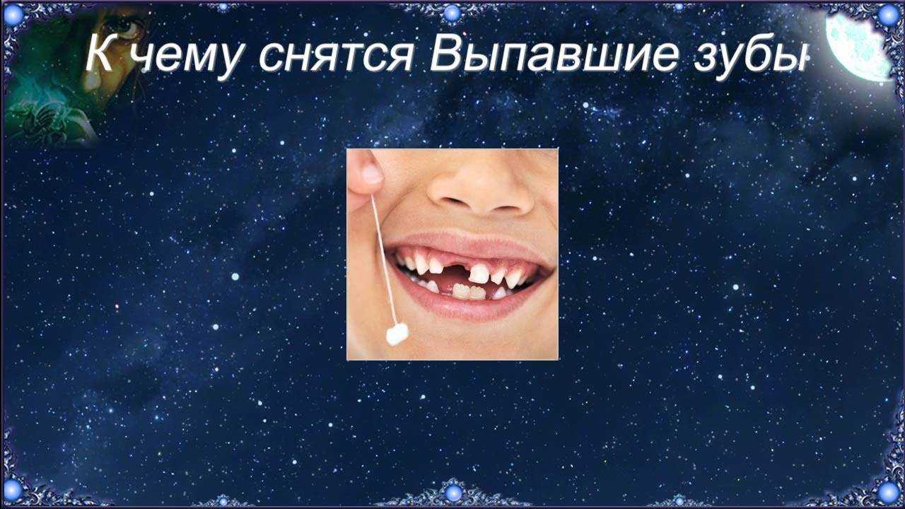 Выпадение зубов без крови