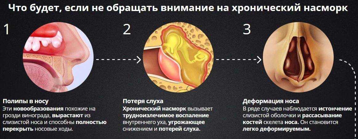 Вам приснился насморк Болели ваши близкие или вы Вы были простужены или у вас заложило нос Или это была аллергия Все самые известные сонники Миллера, Ванги, Фрейда, на нашем сайте