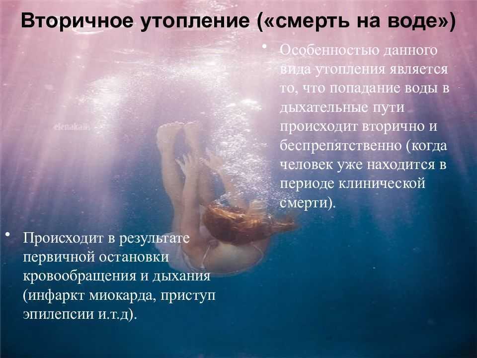 Что означает утопленник во сне? к чему снится утопленник и стоит ли наводить панику