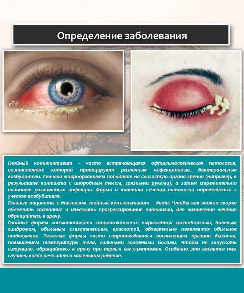 Приснился гной – толкование сна по разным сонникам