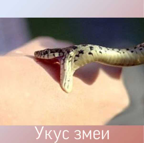 К чему снится змея укусила/кусает - 58 трактовок