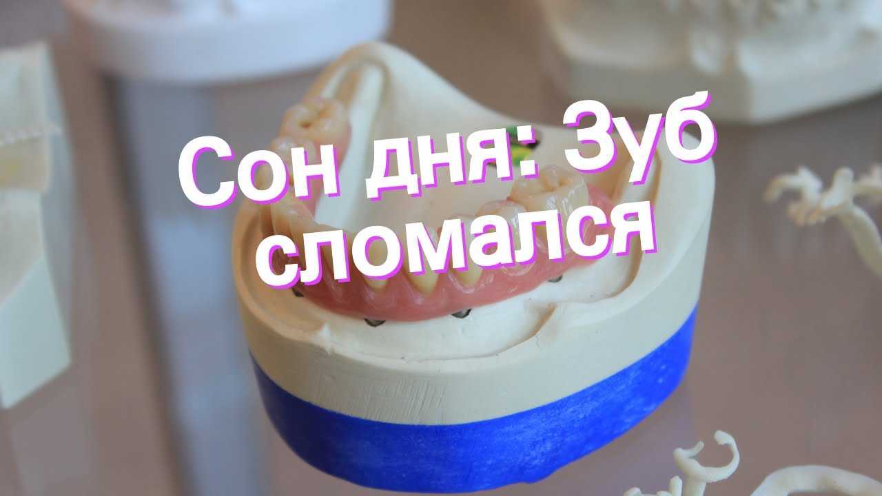 Что значит если откололся зуб во сне