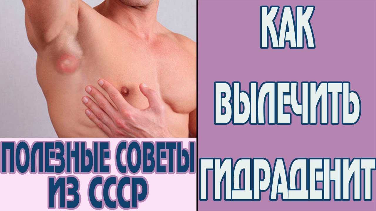 Заговор от чирия: возможность быстро избавиться от напасти