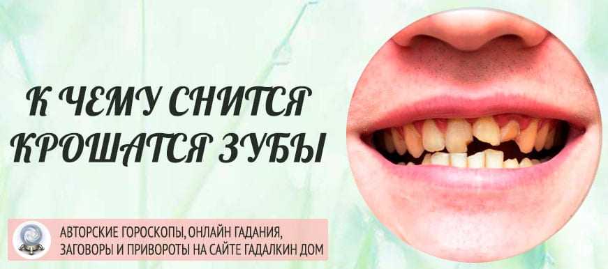 К чему снятся зубы
