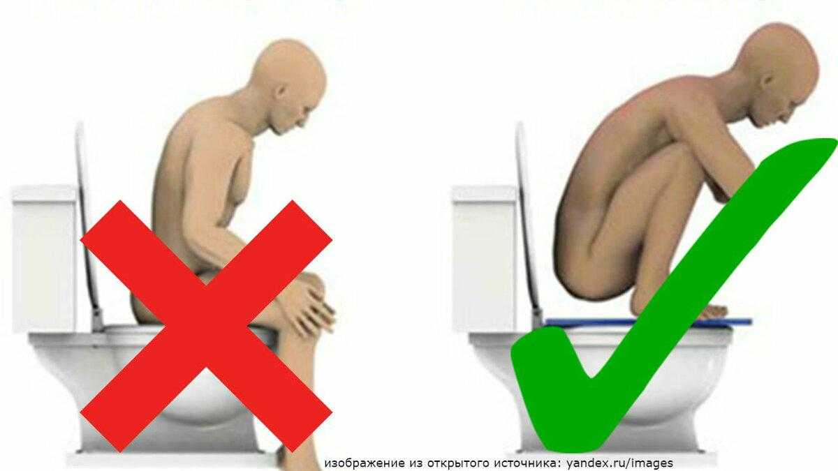 К чему снится сидеть на унитазе — толкование в сонниках