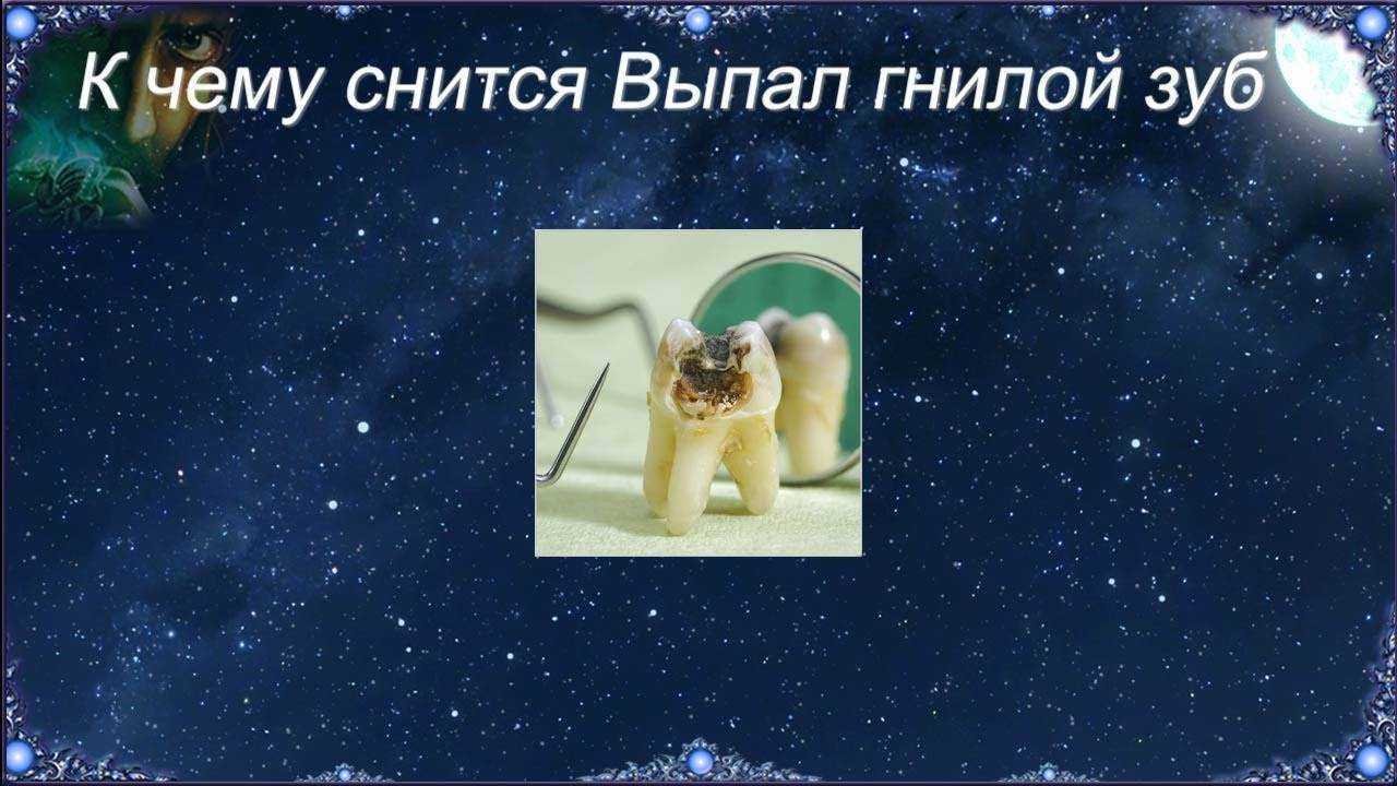 К чему снятся зубы – скрытый смысл сновидений