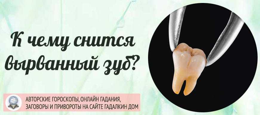 К чему снятся зубы – скрытый смысл сновидений