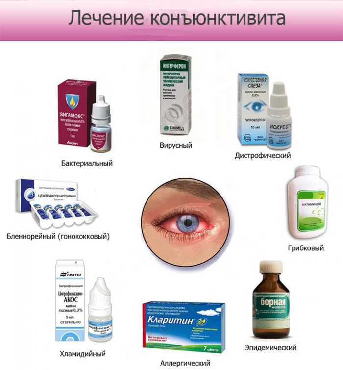 К чему снится конъюнктивит